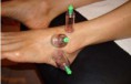 /album/galeria-de-fotos-ventosaterapia/ventosas4-jpg/